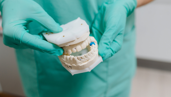 	Implants dentaires : comprendre le fonctionnement