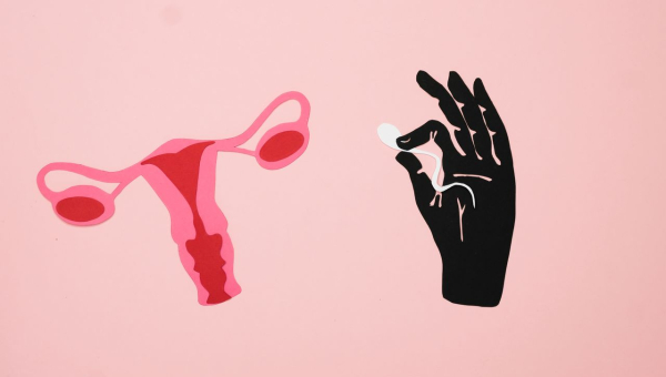 	SOPK : comprendre le syndrome des ovaires polykystiques