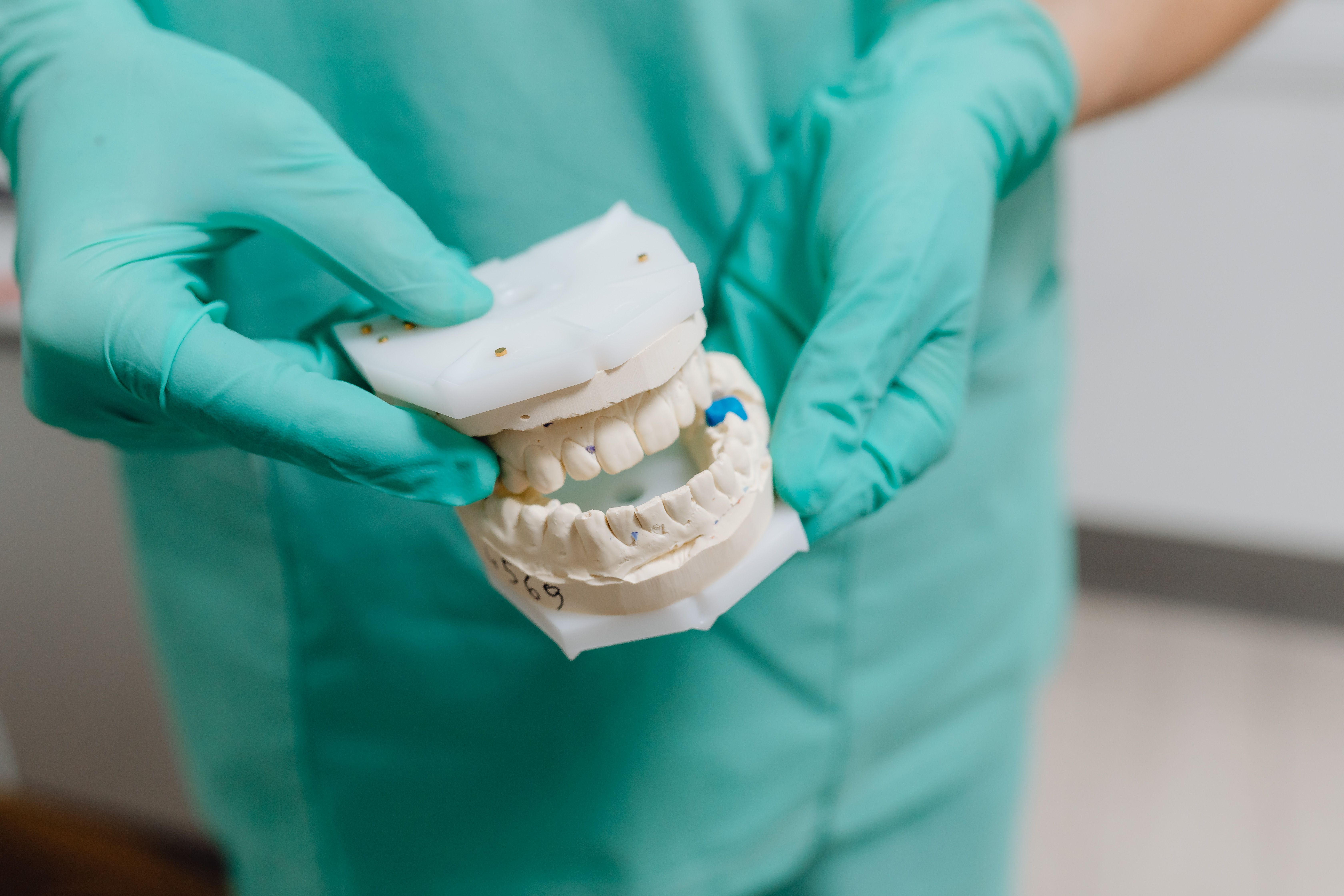 	Implants dentaires : comprendre le fonctionnement