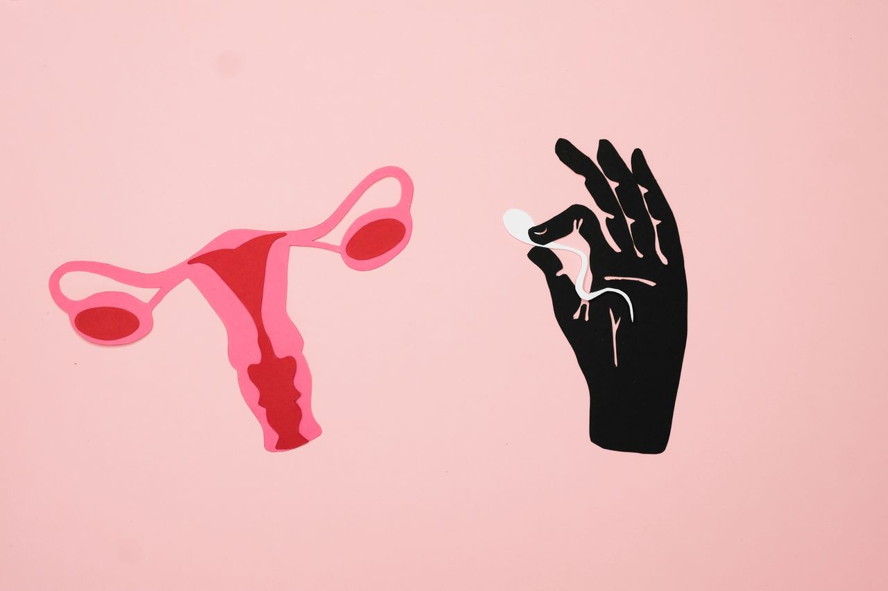 	SOPK : comprendre le syndrome des ovaires polykystiques